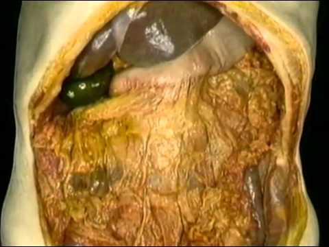 12 Porciones Del Colon
