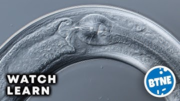 C. Elegans Nematode Roundworm Preforming Elegant Dance Routine! Under The Microscope.