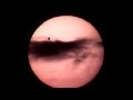 Venus transiting the sun late on 6/5/2012.