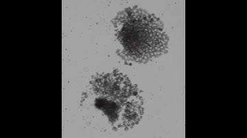 Neural crest cell migration