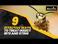 9 Effective Ways to Treat Insect Bites and Stings - Natural Remedies For People Who Loves Outdoors