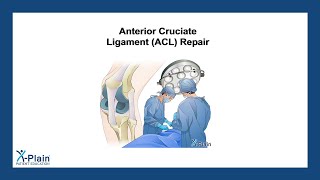 Anterior Cruciate Ligament (ACL) Repair