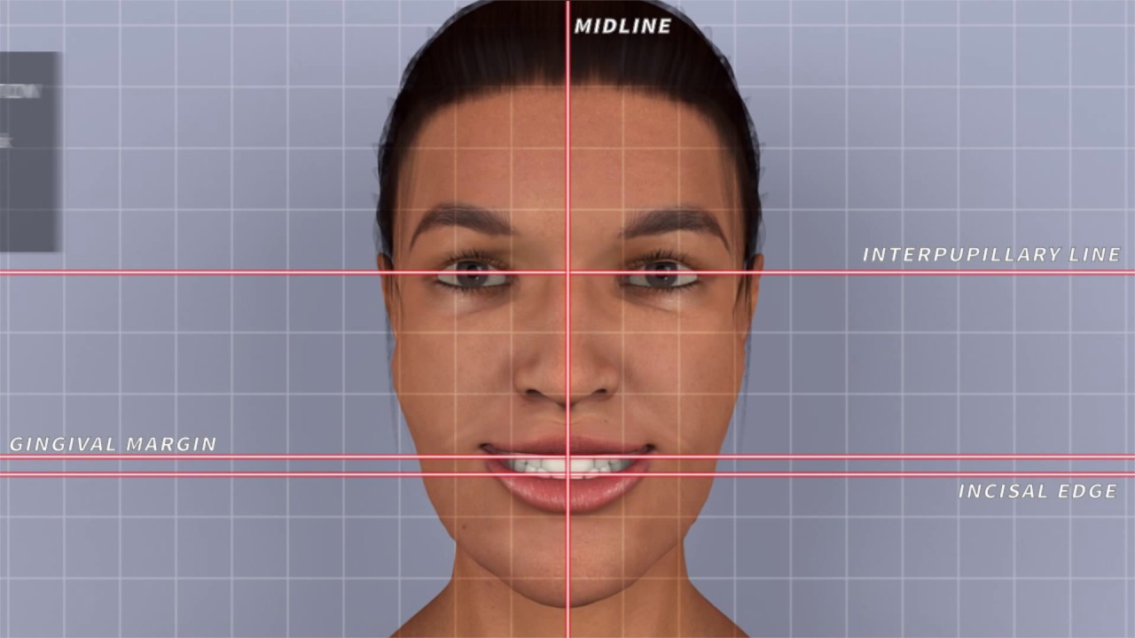 Wagner EZ Fit Protocol - 3, 30-Min Appts