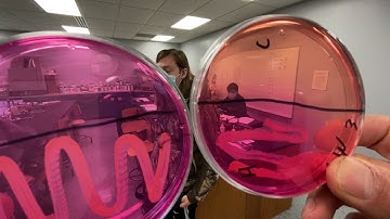 Discussion of lab Epidemic Simulation