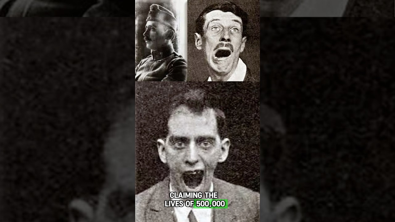 The ‘Sleeping Statue’ Pandemic of the 1920s 💀