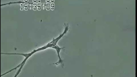 Effects of Mercury on Brain Neuron Degeneration