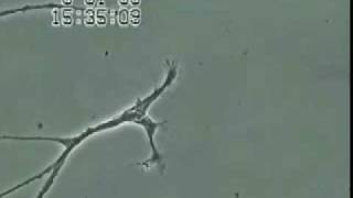 Effects of Mercury on Brain Neuron Degeneration