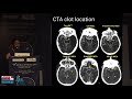 DEFUSE 3 and Recent Stroke Trials - Prof P N Sylaja