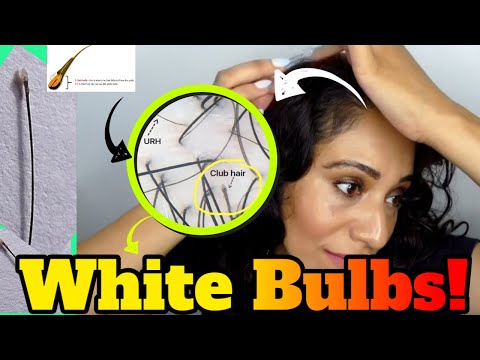 What Are Those White Bulbs at the ends of your hair?