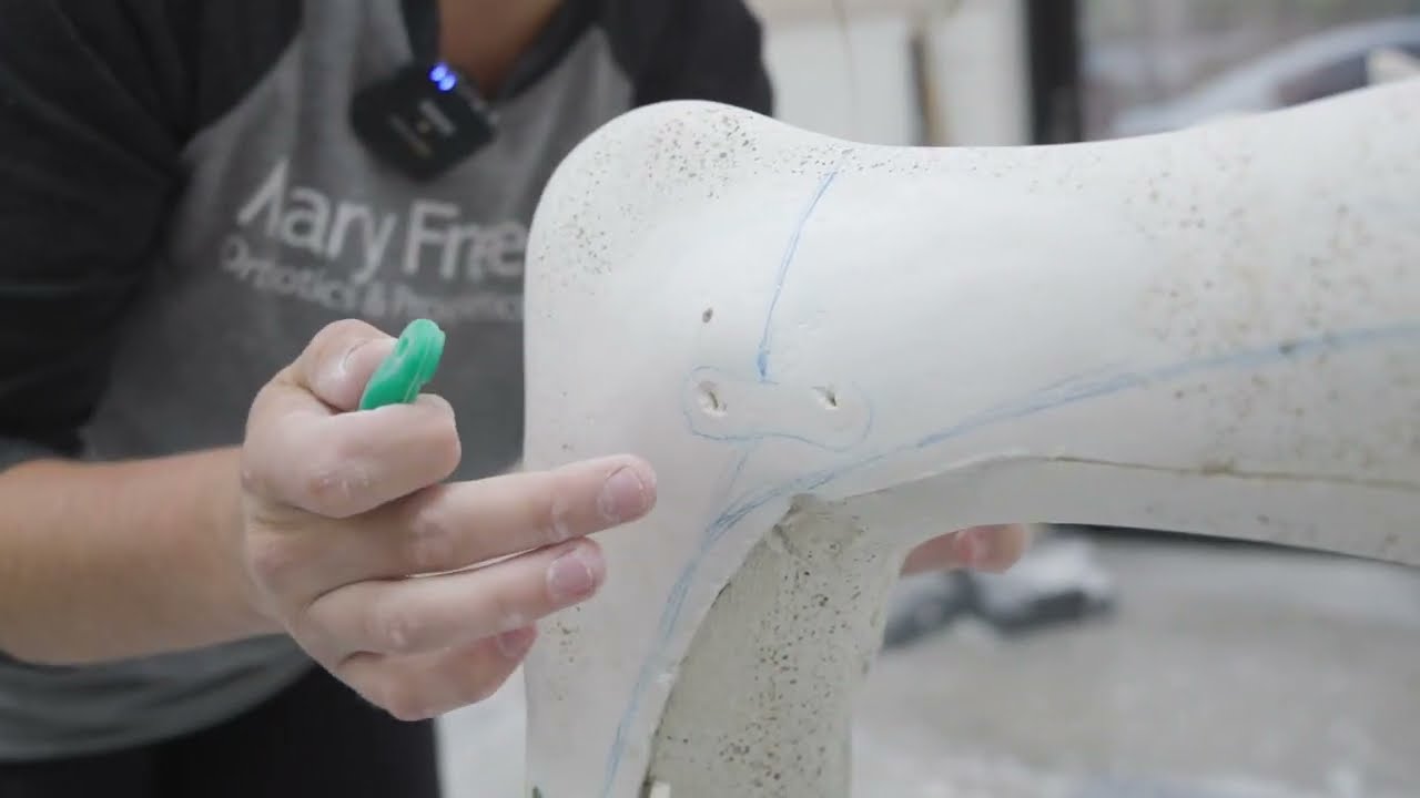 How to make a custom AFO (ankle foot orthosis)