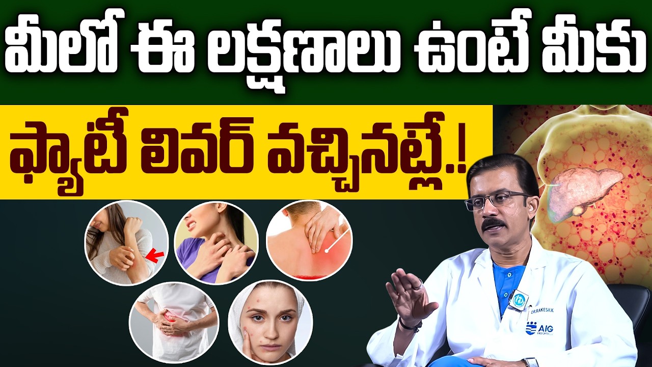 Dr Rakesh - మీలో ఈ లక్షణాలు ఉంటే మీకు ఫ్యాటీ లివర్ ఉన్నట్లే.! | Fatty Liver Symptoms | iDream