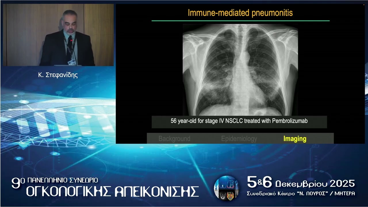 Ανοσοθεραπεία στους ογκολογικούς ασθενείς | Κ. Στεφανίδης