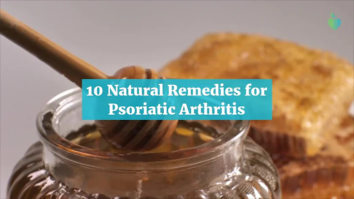 10 Natural Remedies for Psoriatic Arthritis