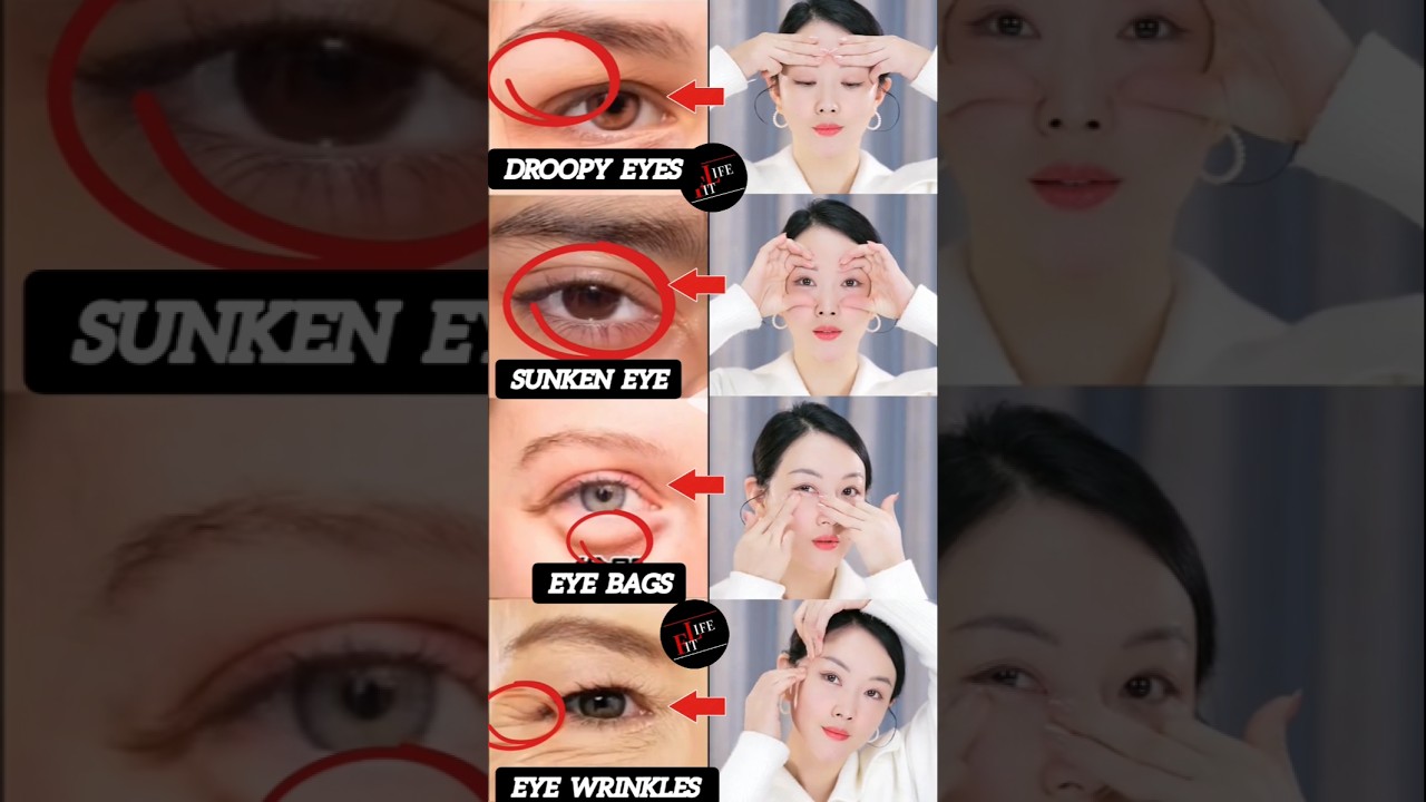 A Complete Solution For Eye Area Problems | Korean Yoga 😱 