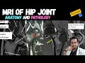 MRI Hip joint Anatomy and Some common Pathology | MRI Technique Course Tutorial-41 |