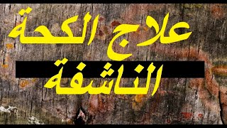 علاج الكحة الناشفة - لا كحة بعد اليوم باذن الله