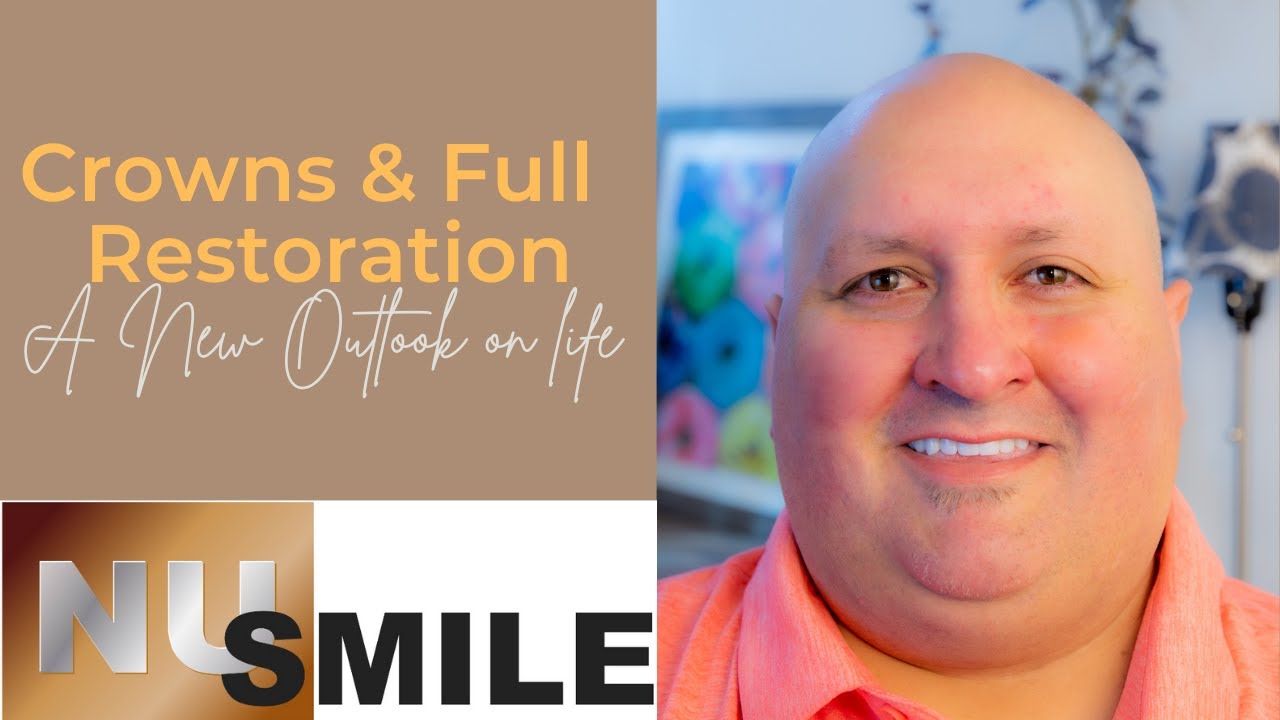 Full Mouth Restoration Relieved Pain and Created a New Smile