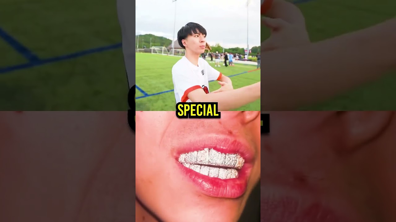 Silky Asks Ray Where His Grillz At! 😭💎