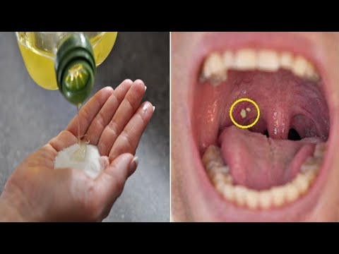 Video: A është e keqe frymëmarrja nga goja?