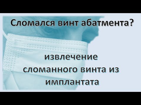 Извлечение сломанного винта абатмента из имплантата. Как выкрутить винт безопасно из импланта.