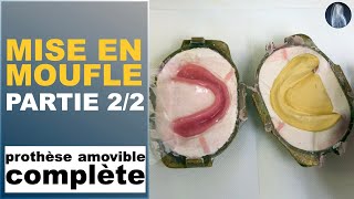 Mise en moufle | Résine et polymérisation | Partie 2/2 | Prothèse amovible complète | ©