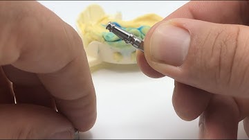 TRI® 2in1 Impression Abutment Tutorial with Holger Kast