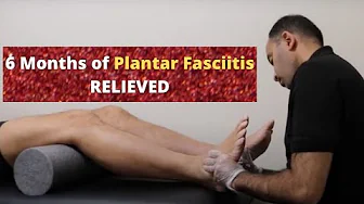 6 Months of Plantar Fasciitis Relieved In Minutes (REAL RESULTS!!!!)