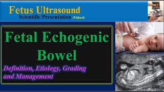 Fetus Ultrasound , Fetal Echogenic Bowel screenshot 5