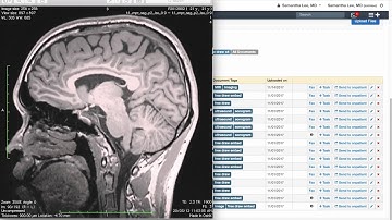 Training: DrChrono Charts and Clinical Notes | Patient Documents