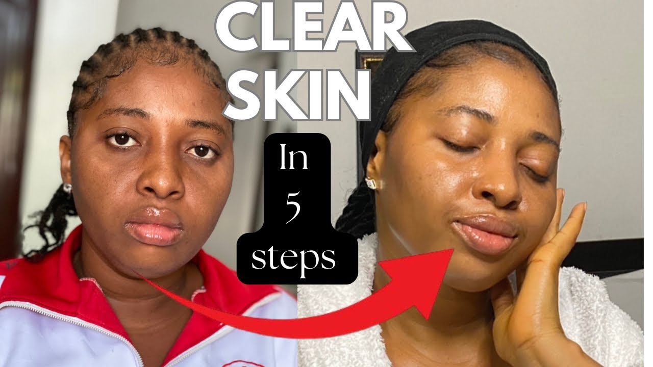 AM & PM SKINCARE ROUTINE FOR GLOWING SKIN |GET RID OF HYPERPIGMENTATION ...