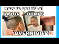Say Good Bye to Razor Bumps ! Healthy Hair results to a Quick Solution