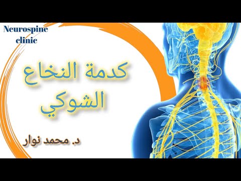 كدمات النخاع الشوكي