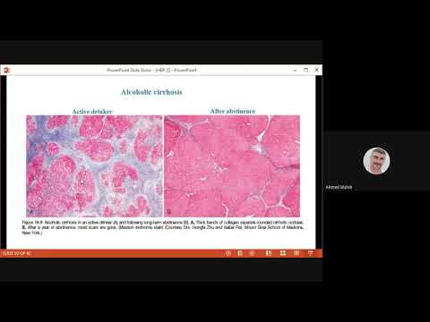 Pathology  / Hepatobillary system / lecture 3