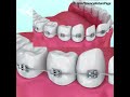 All about dentistry animation 3d  dental animation patient education 3d dental 3d