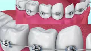 All About Dentistry Animation 3D Video Dental Animation Patient Education 3D Video Dental 3D Video