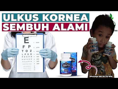 Cara Menyembuhkan Ulkus Kornea atau Kornea Mata Luka Secara Alami || Testimoni Sehat Mata Limatta