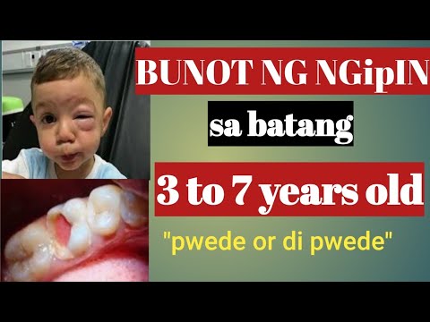 Video: Hanggang Sa Anong Edad Ang Nagbabago Ng Ngipin Ng Gatas Sa Mga Bata?