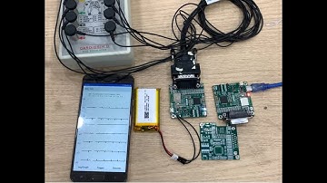 ECG signal with nrf ble