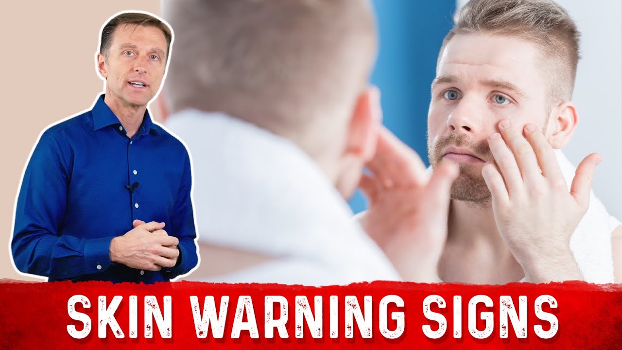 7 Skin Warning Signs of Diabetes - YouTube