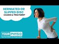 What is a herniated disc and how to recover from it? Pain-Free Tips by your Physio