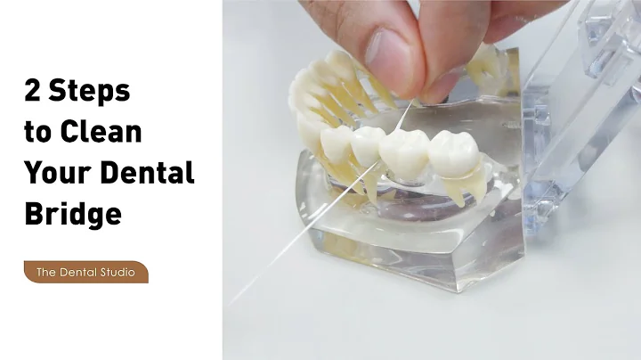 How to Clean a Dental Bridge with a Floss Threader