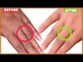 #1 How To Make Your Hands Look 5 Years Younger | get wrinkle free smooth clear hands