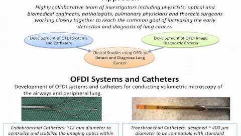 In vivo diagnosis of lung cancer using optical frequency domain imaging - Melissa Suter