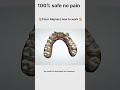 Clear Aligners #aligner #dentist#DRIshratMafruha #Denta #shorts #funny #machine #dental