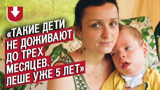 У моего сына генетическая мутация: Катя | Быть мамой