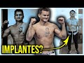 Los IMPLANTES ABDOMINALES del CHINO MAIDANA