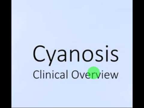 Video: Heavenly Inflorescences Of Cyanosis. Varieties