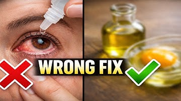 Oogdruppels zijn niet de oplossing voor droge ogen — pak dit eerst aan | Dr. Mandell