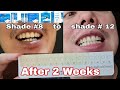AFTER 15 DAYS | HOW TO CORRECTLY USE PERFECT SMILE PH TEETH WHITENING WITH TOOTH SHADE RESULT