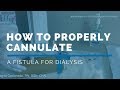 *FREE DIALYSIS TRAINING VIDEO*: HOW TO PROPERLY CANNULATE A FISTULA